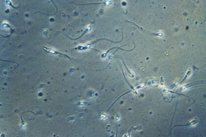 Ce à quoi s’attendre lors d’une analyse de sperme et ce que les résultats signifient