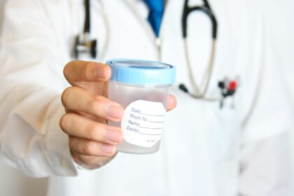 Comment recueillir du sperme pour un test d’analyse du sperme